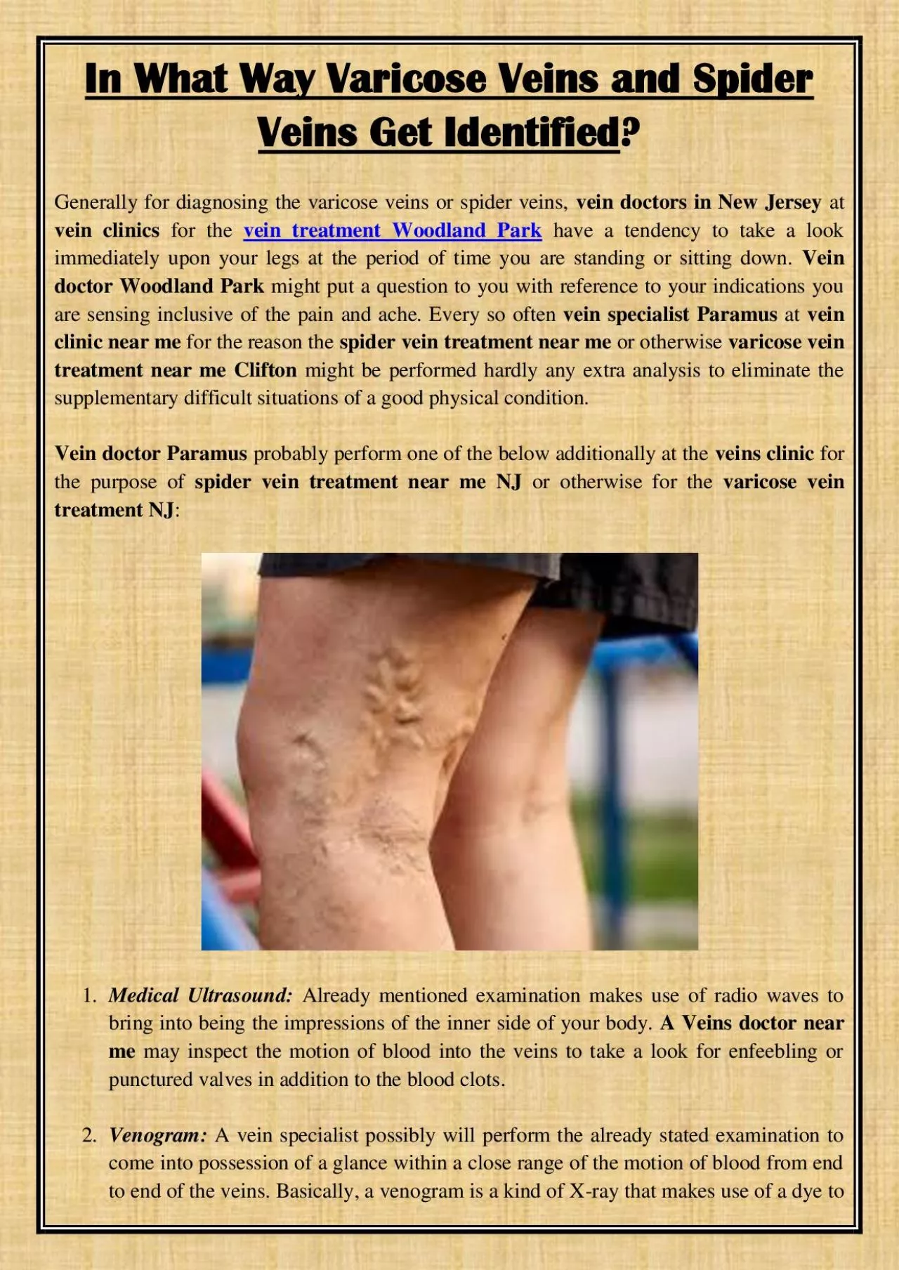 PDF-In What Way Varicose Veins and Spider Veins Get Identified?