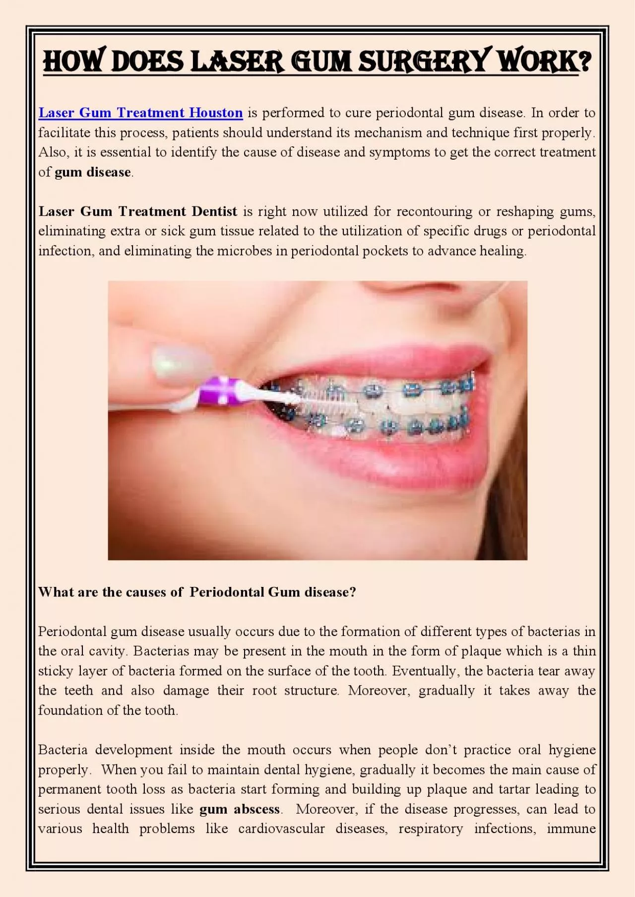 PDF-How Does Laser Gum Surgery Work?