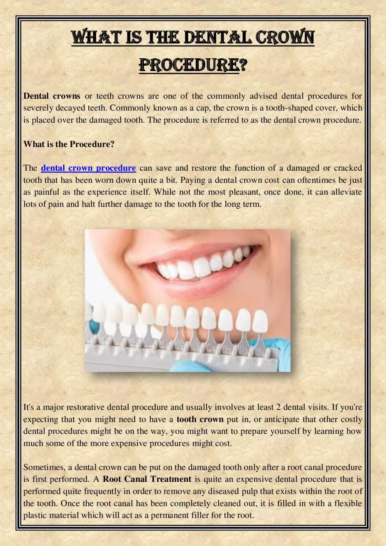 PDF-What is the Dental Crown Procedure?