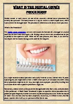 What is the Dental Crown Procedure?