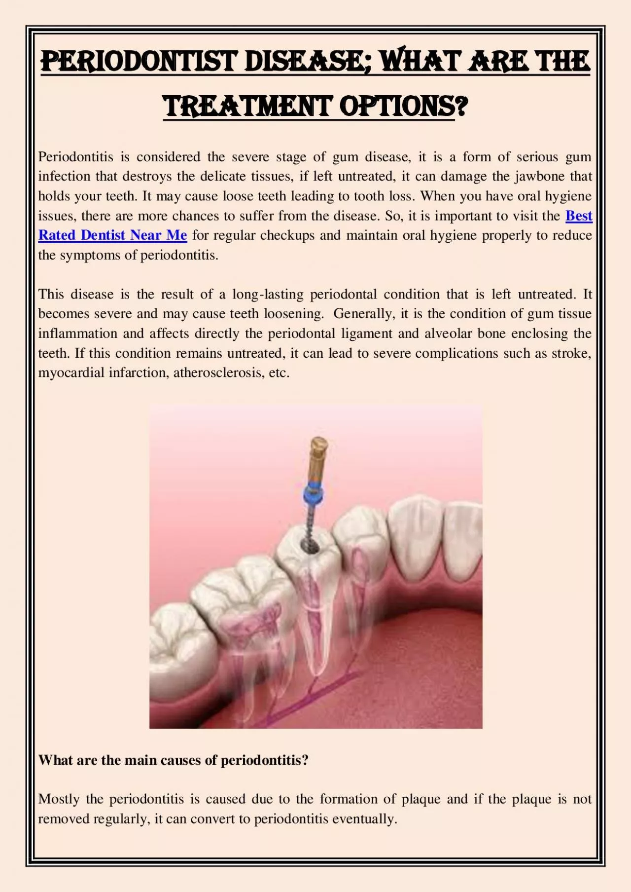 PDF-Periodontist Disease; What are the Treatment Options?