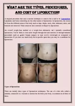 What are the Types, Procedures, and Cost of Liposuction?