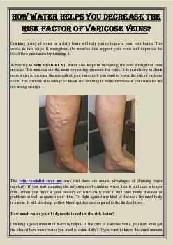 How water helps you decrease the risk factor of varicose veins?