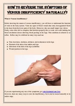 How To Reverse The Symptoms Of Venous Insufficiency Naturally?