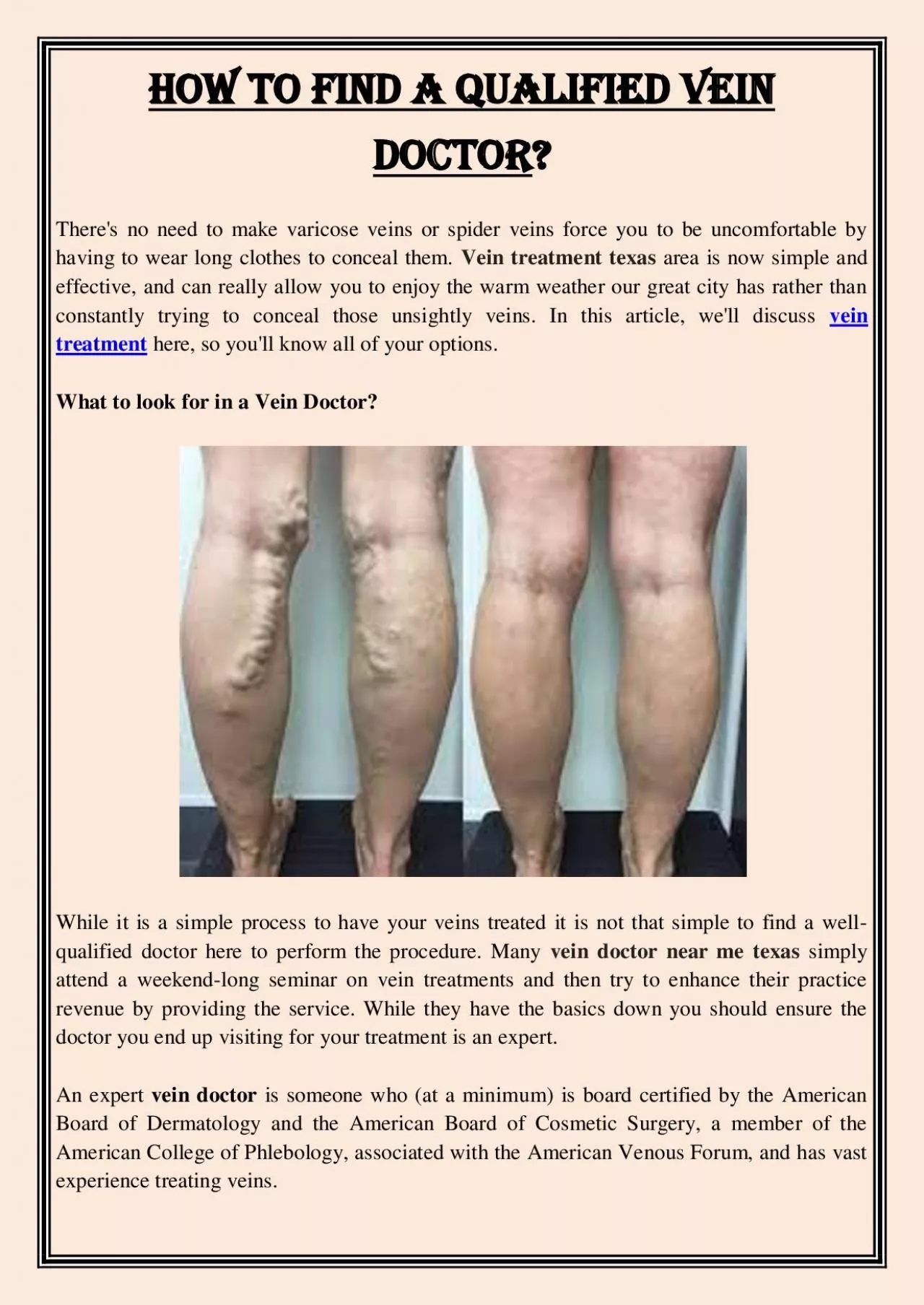 PDF-How to Find A Qualified Vein Doctor?