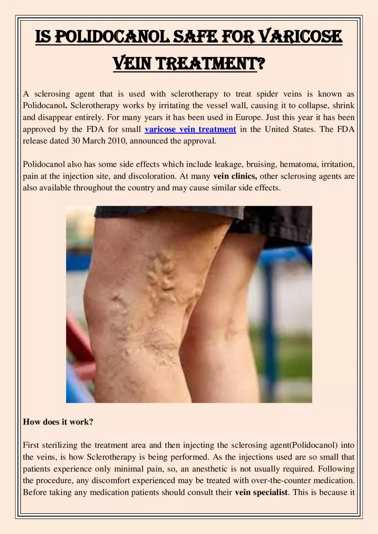 PDF-Is Polidocanol Safe For Varicose Vein Treatment?