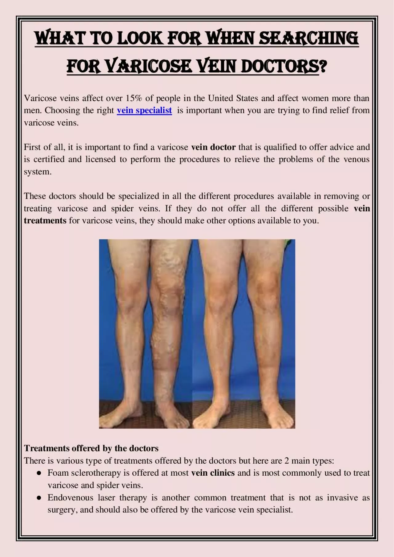 PDF-What to Look for When Searching for Varicose Vein Doctors?