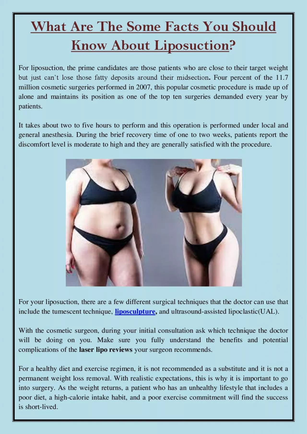 PDF-What Are The Some Facts You Should Know About Liposuction?