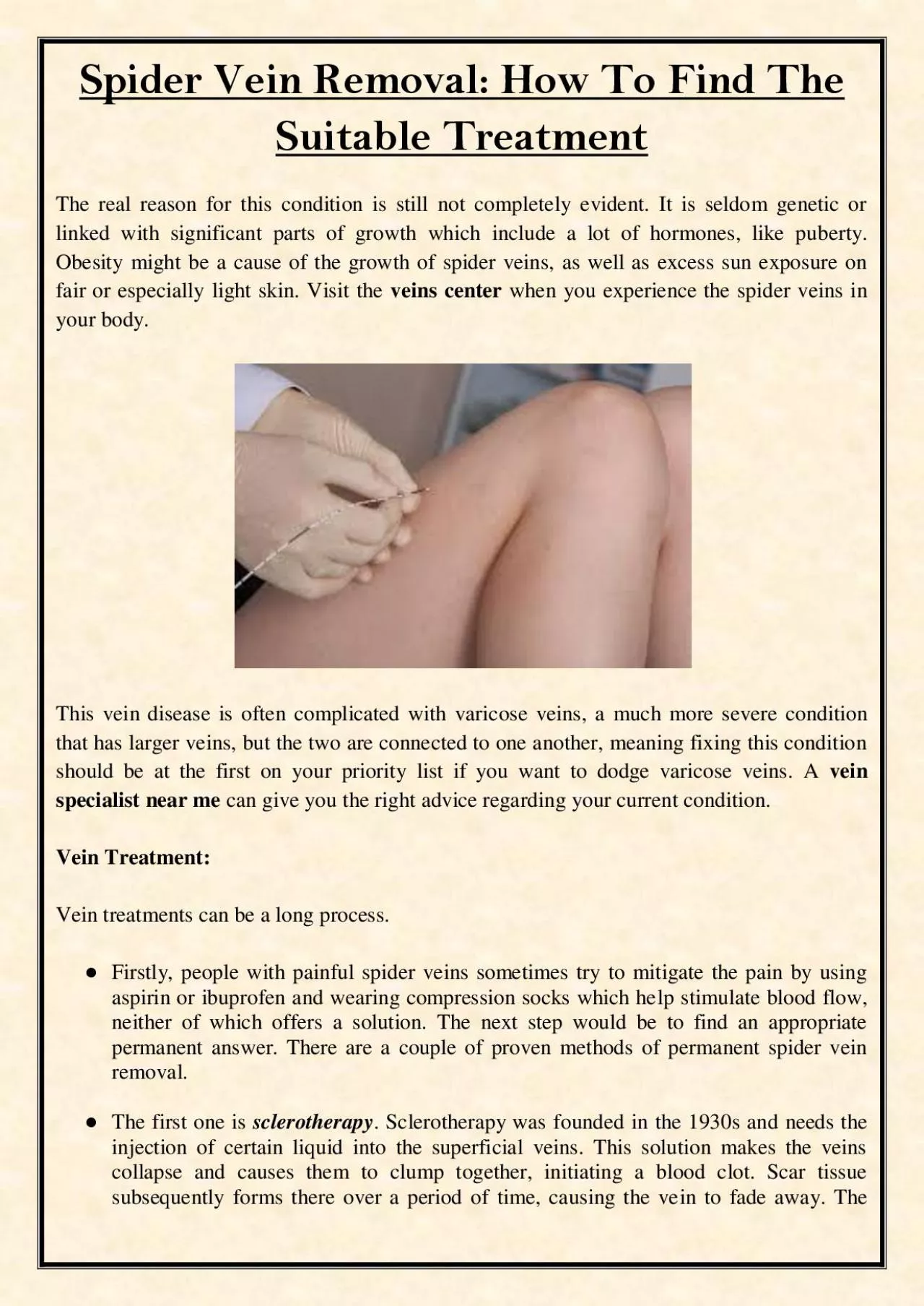 PDF-Spider Vein Removal: How To Find The Suitable Treatment