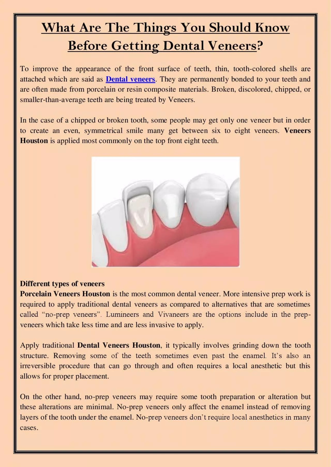 PDF-What Are The Things You Should Know Before Getting Dental Veneers?