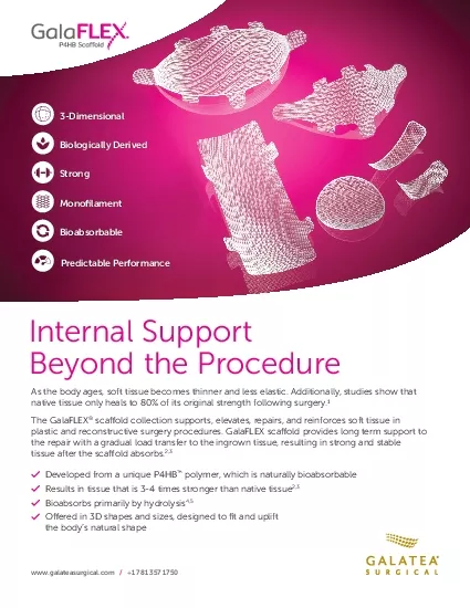 PDF-Internal SupportBeyond the Procedure