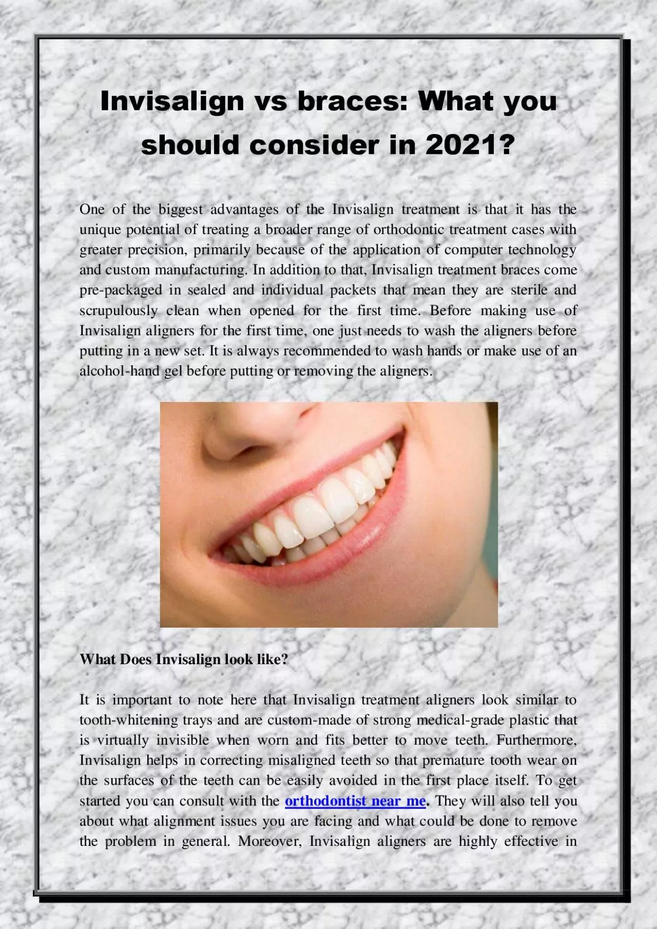 PDF-Invisalign vs braces: What you should consider in 2021?