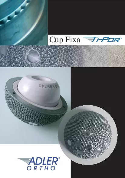 The uncemented cup with equatoconsidered to be the best solution for