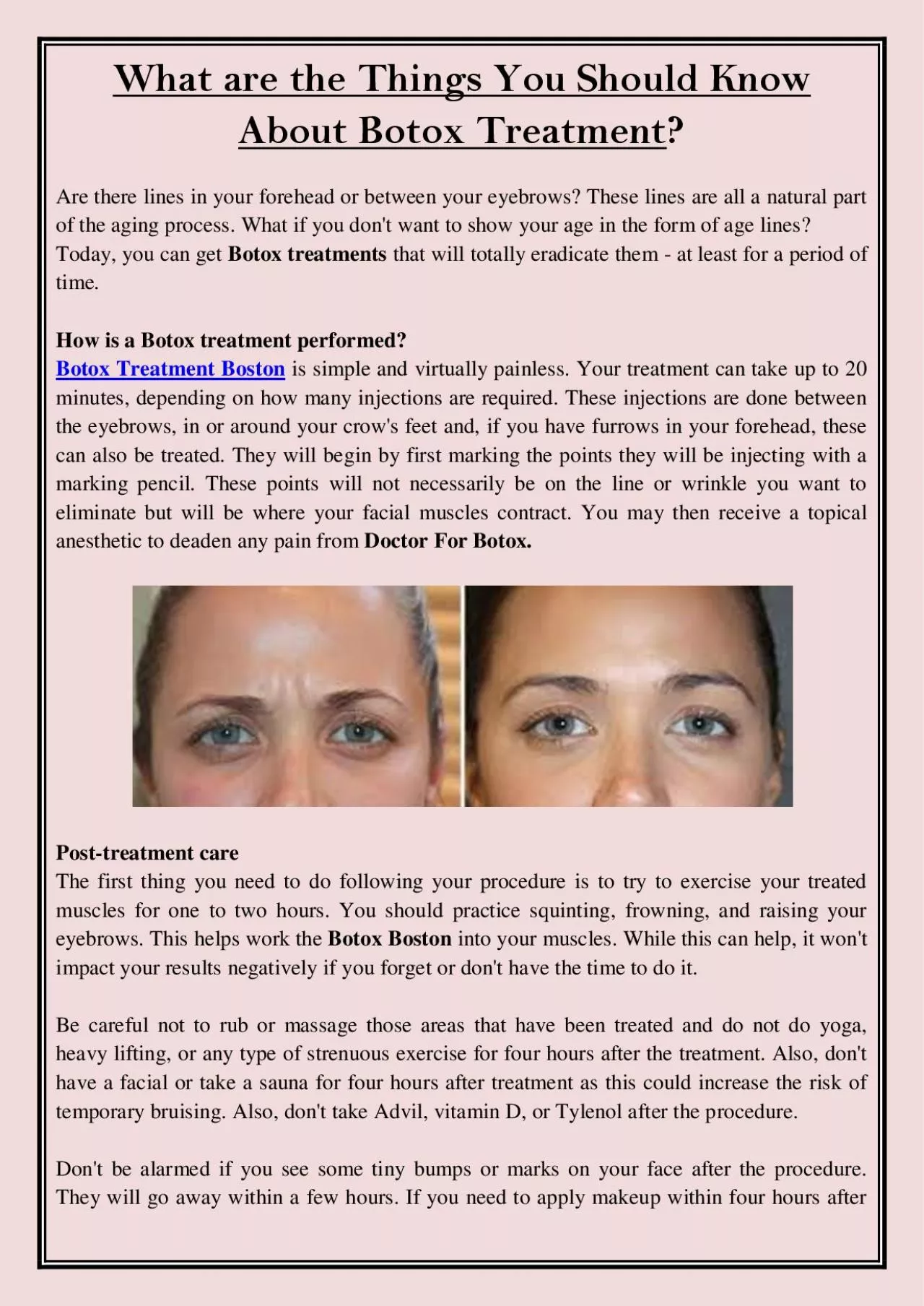 PDF-What are the Things You Should Know About Botox Treatment?