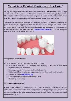 What is a Dental Crown and its Cost?