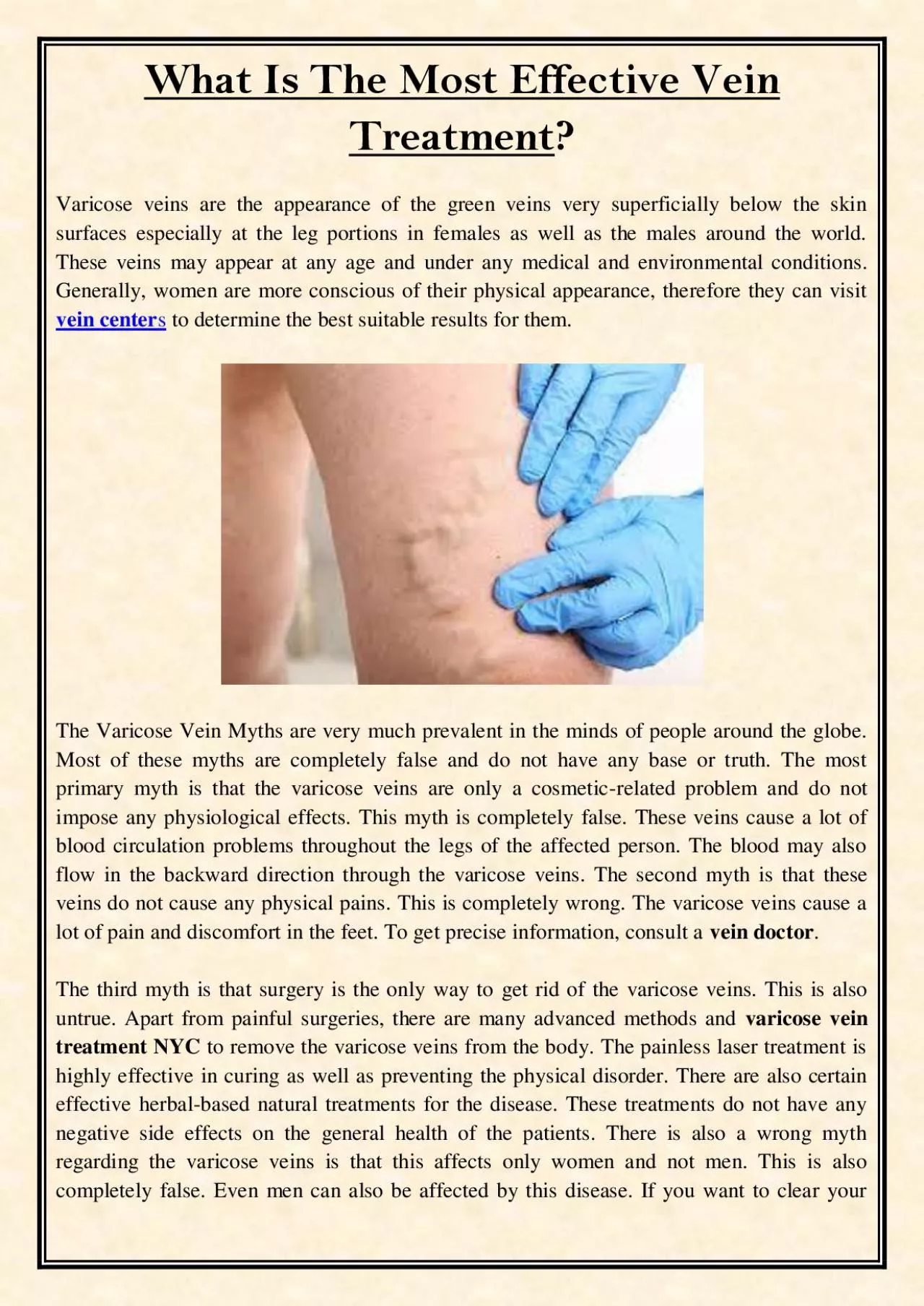 PDF-What Is The Most Effective Vein Treatment?