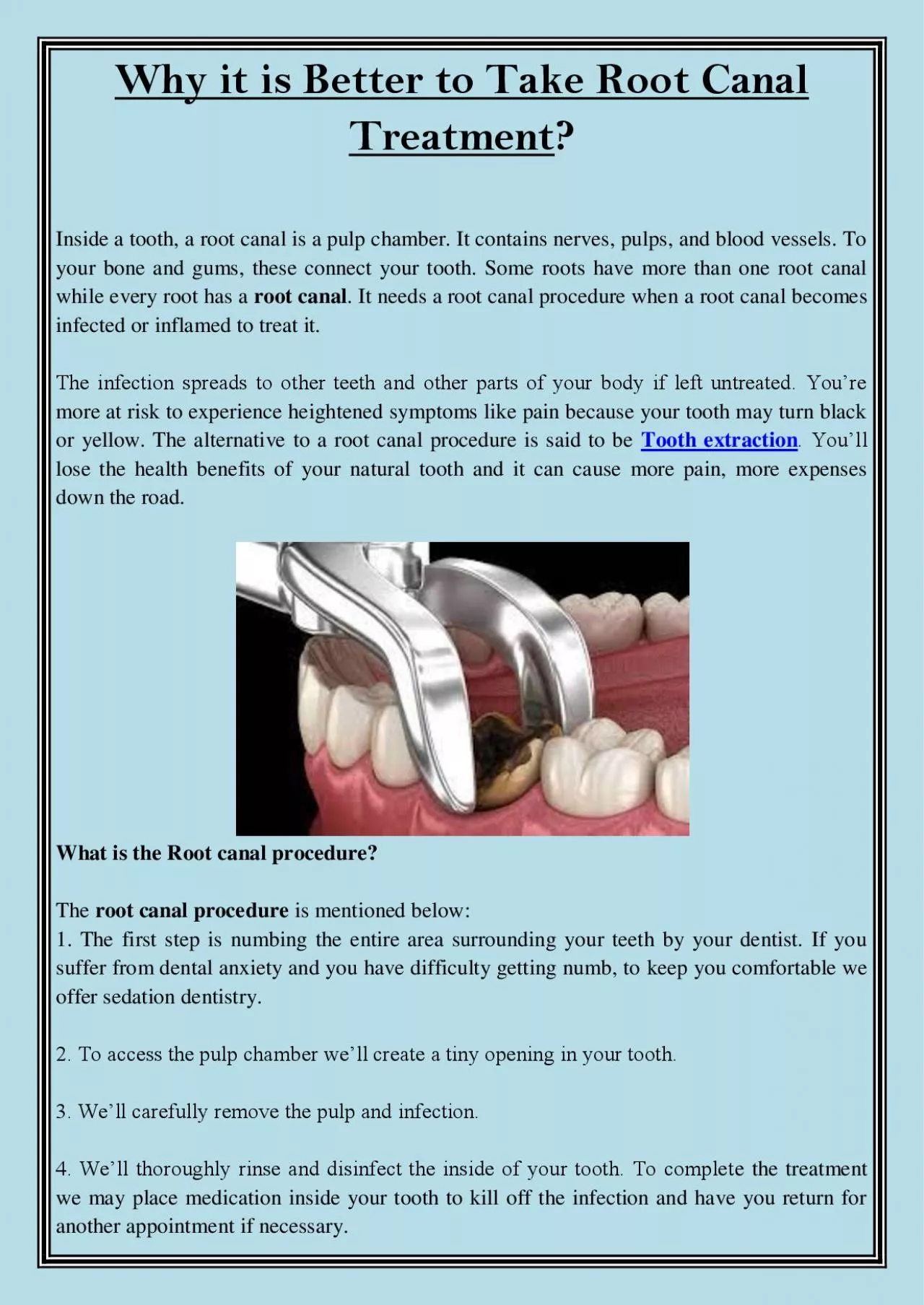 PDF-Why it is Better to Take Root Canal Treatment?