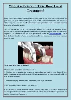 Why it is Better to Take Root Canal Treatment?