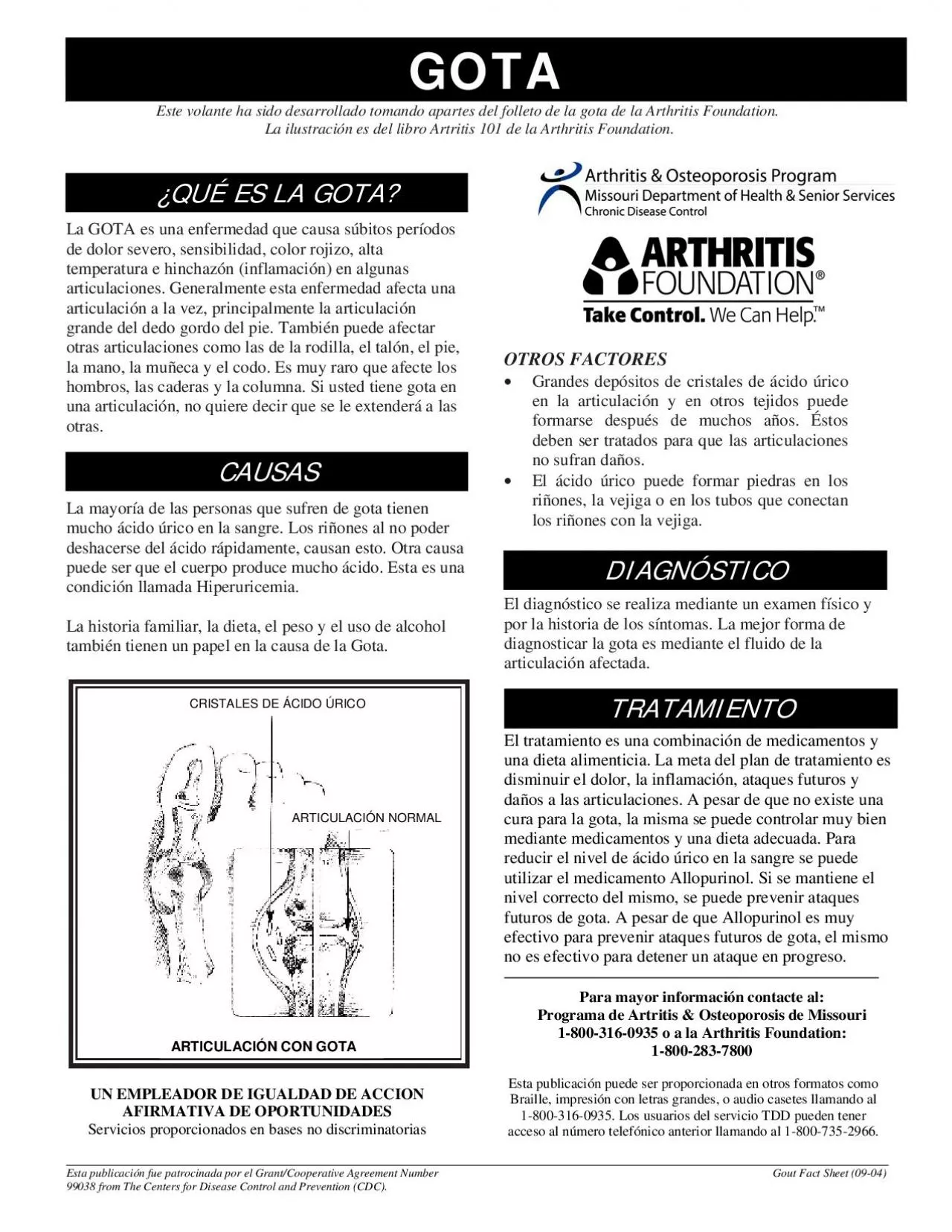 PDF-La mayora de las personas que sufren de gota tienen mucho cido rico en