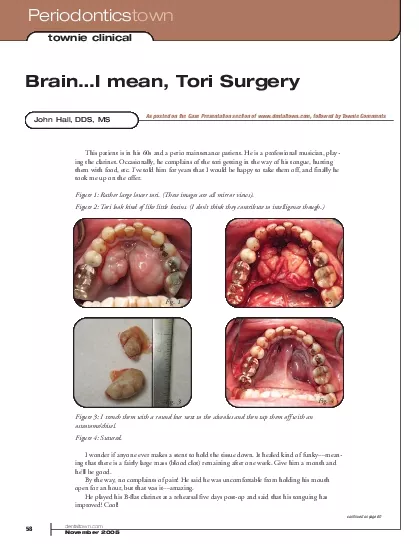 Figure 1 Rather large lower tori These images are all mirror views Fig