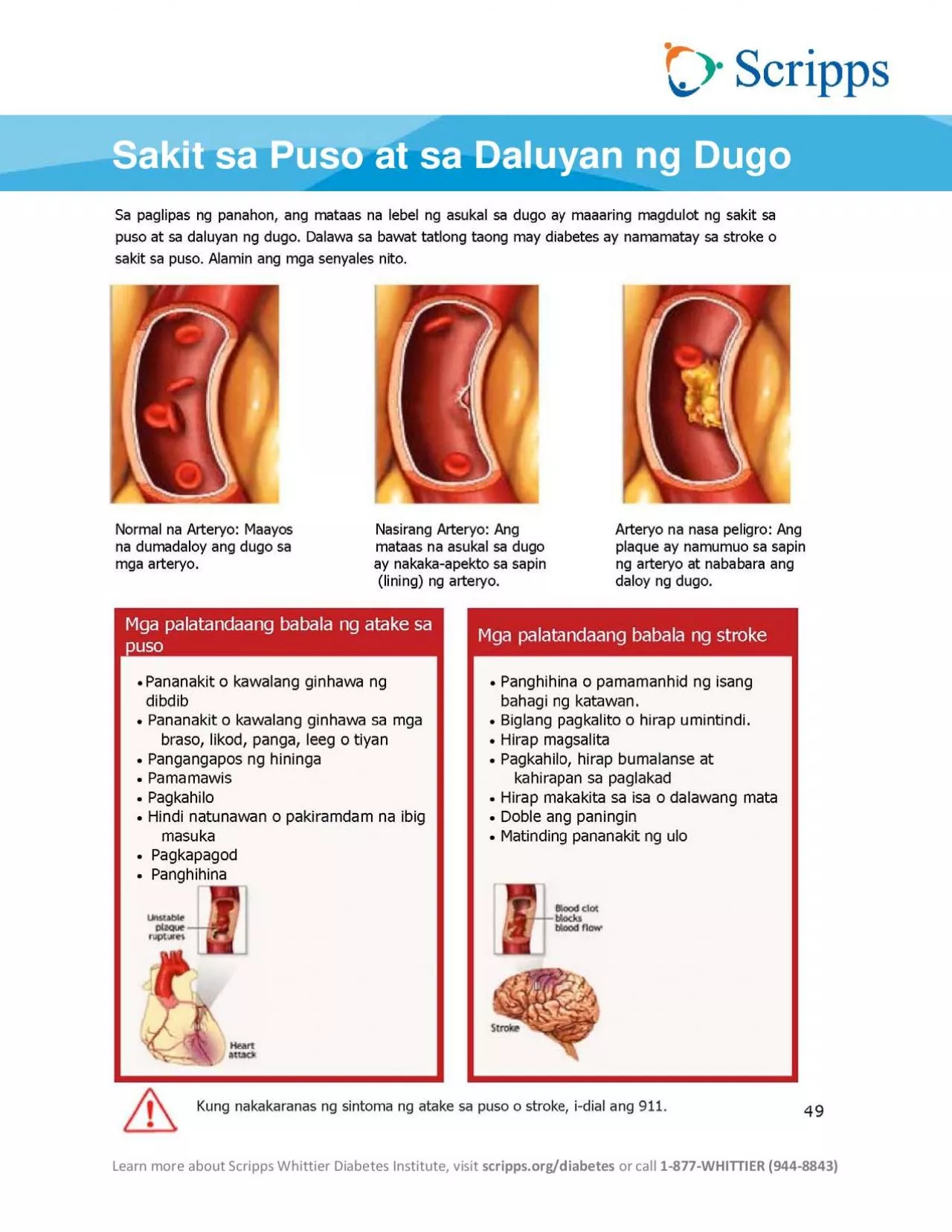 PDF-Sakit sa Puso at sa Daluyan ng Dugo