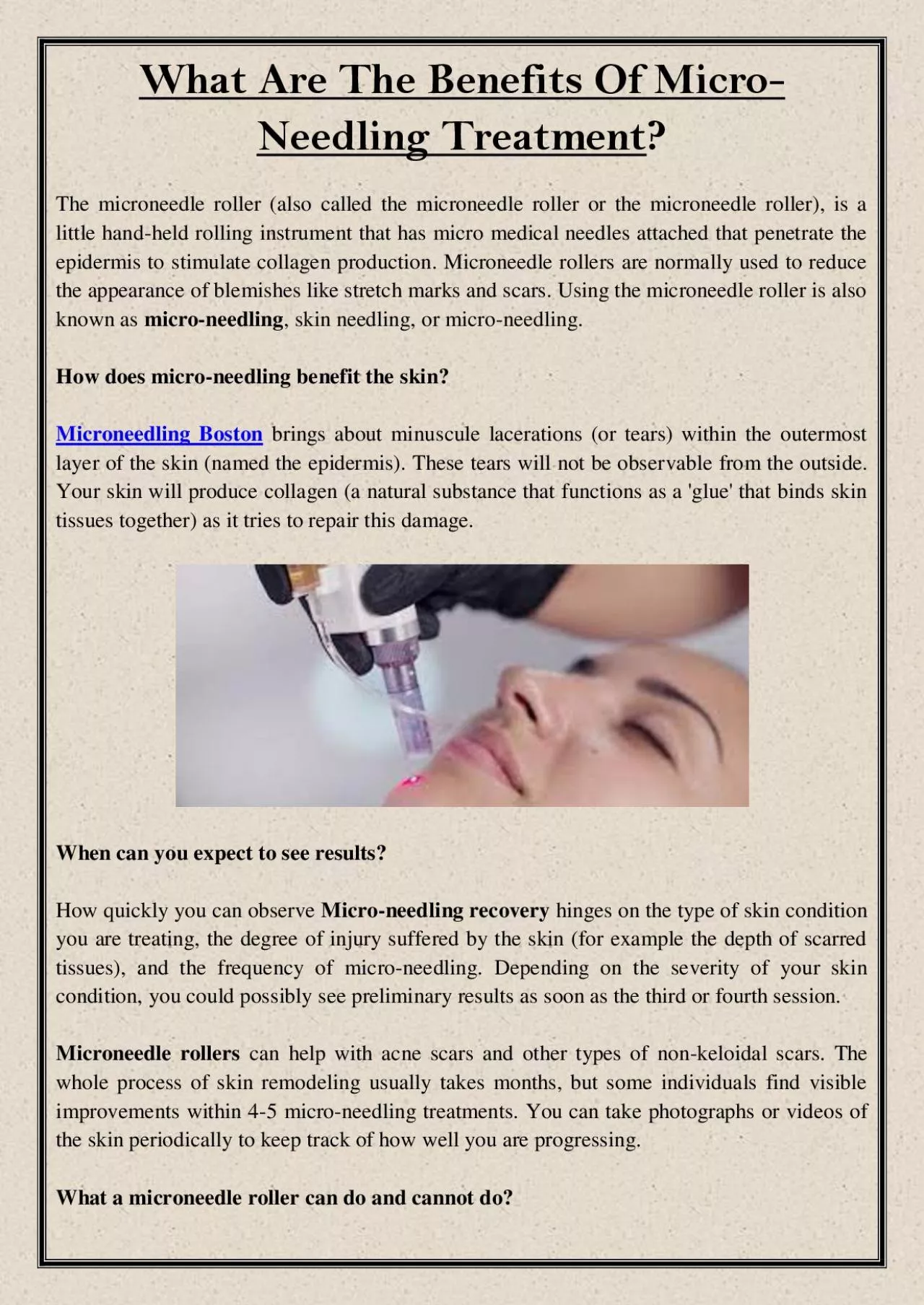 PDF-What Are The Benefits Of Micro-Needling Treatment?