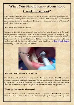 What You Should Know About Root Canal Treatment?