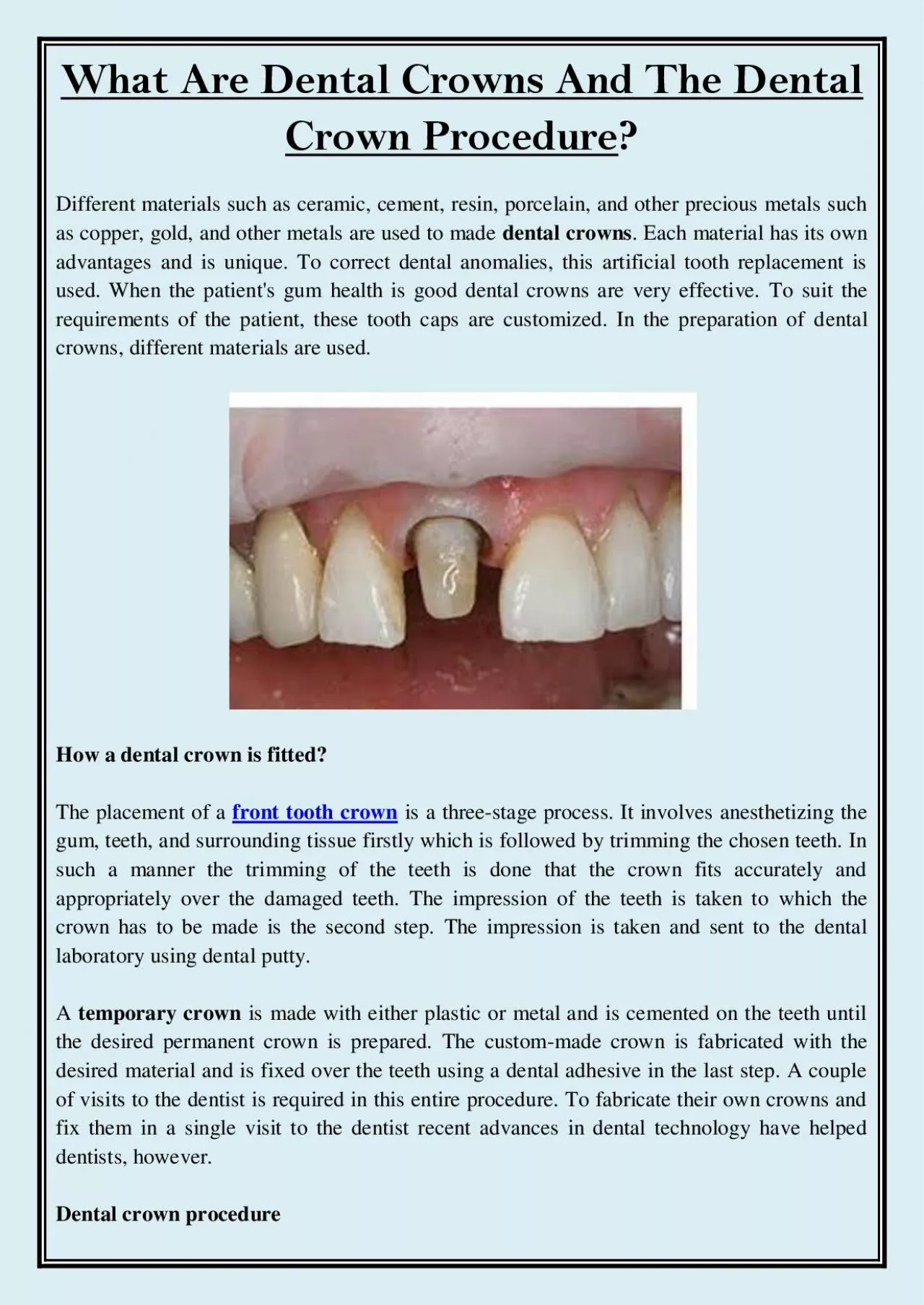 PDF-What are Dental Crowns and the Dental Crown Procedure?