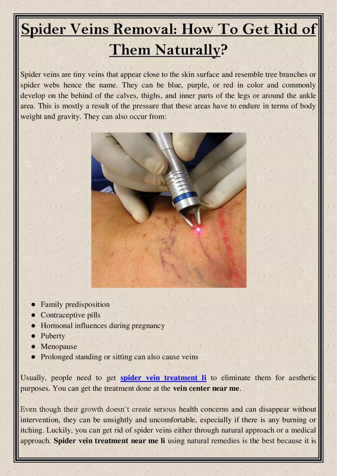 PDF-Spider Veins Removal: How To Get Rid of Them Naturally?