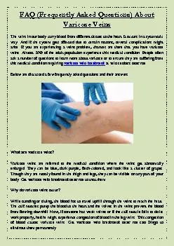 FAQ (Frequently Asked Questions) About Varicose Veins