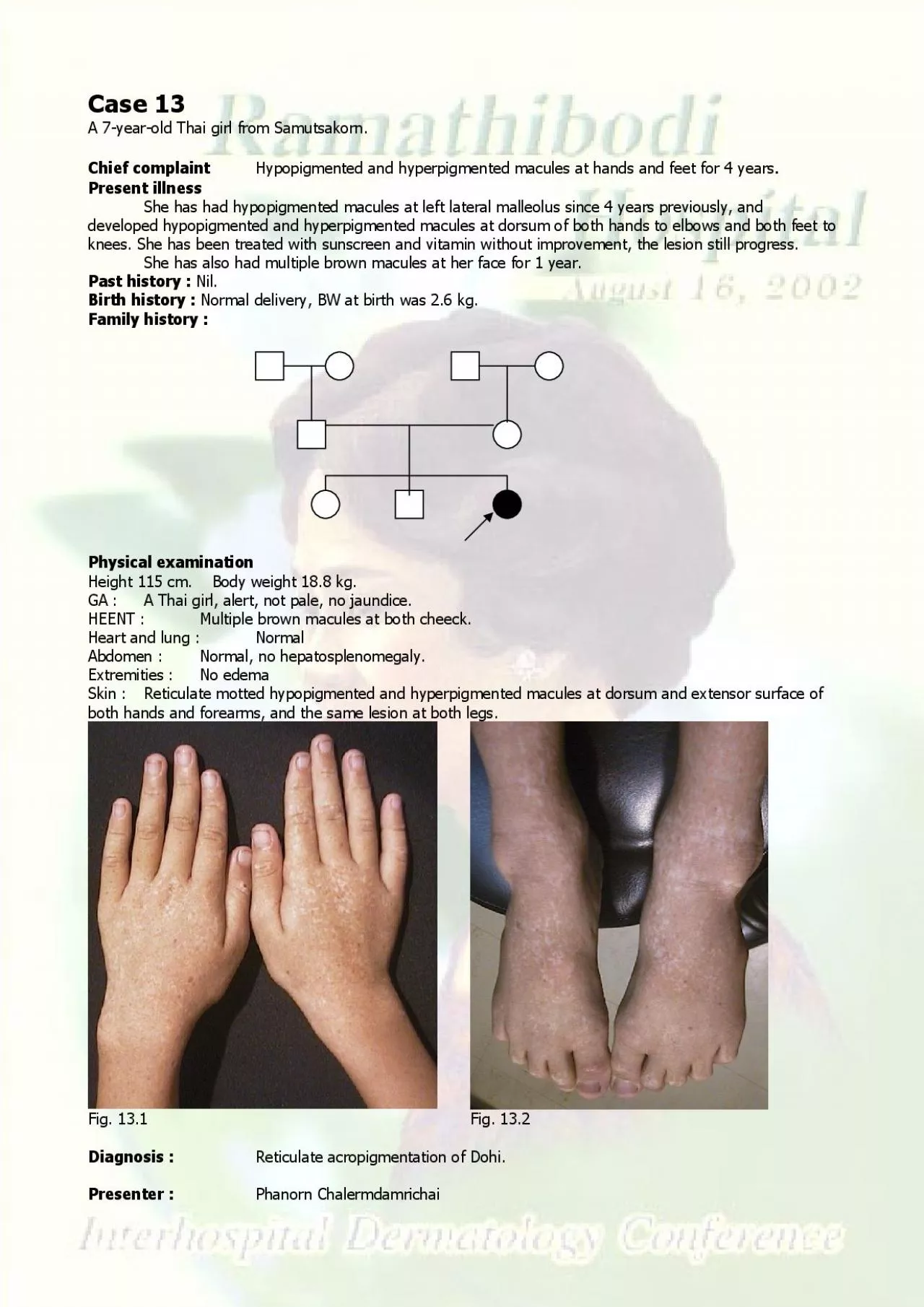 PDF-A 7yearold Thai girl from Samutsakorn Hypopigmented and hyperpigment