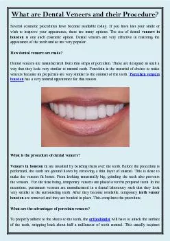 What are Dental Veneers and their Procedure?