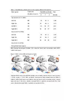 The difference in ReHo value in brain regions between SLE and HC