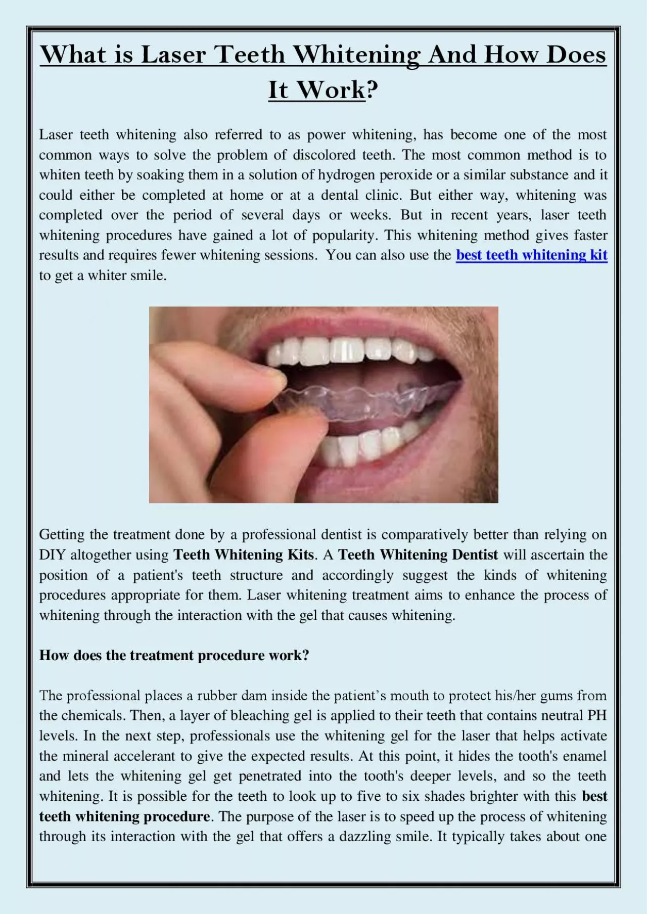 PDF-What is Laser Teeth Whitening And How Does It Work?