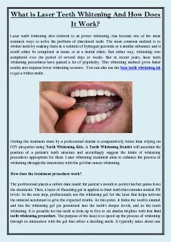 What is Laser Teeth Whitening And How Does It Work?