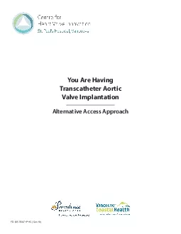 You Are Having Transcatheter AorticValve ImplantationAlternative Acces