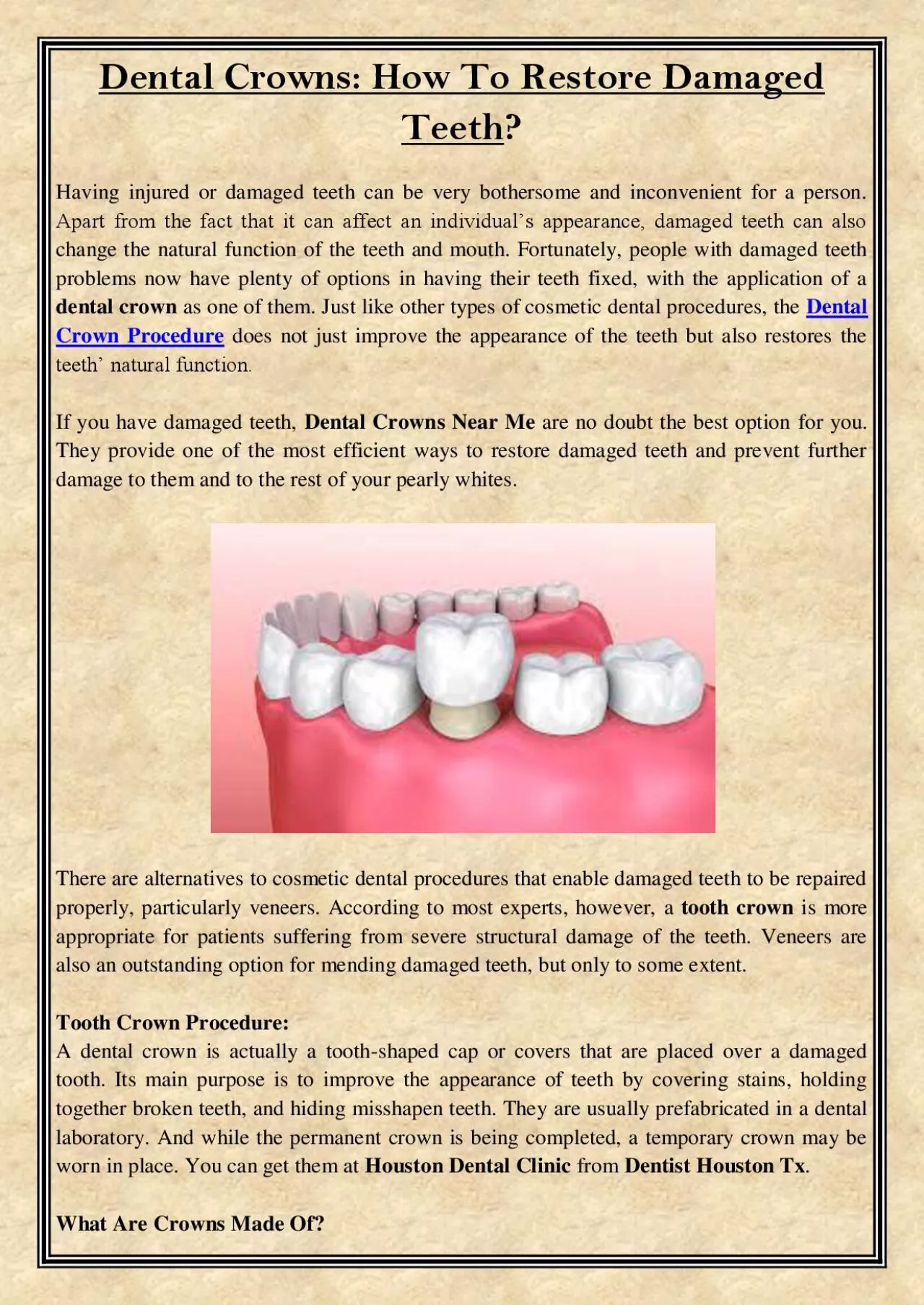 PDF-Dental Crowns: How To Restore Damaged Teeth?