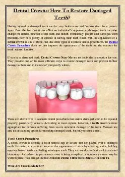 Dental Crowns: How To Restore Damaged Teeth?