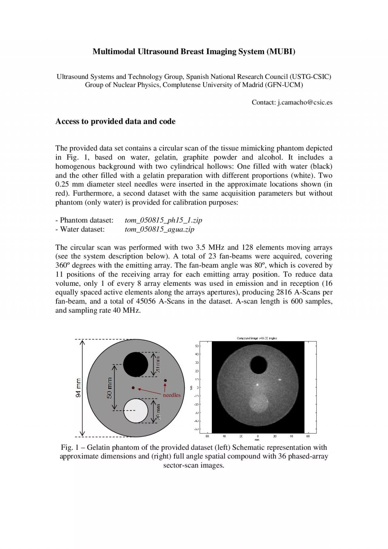 PDF-Multimodal Ultrasound Breast Imaging System MUBI Ultrasound Systems an