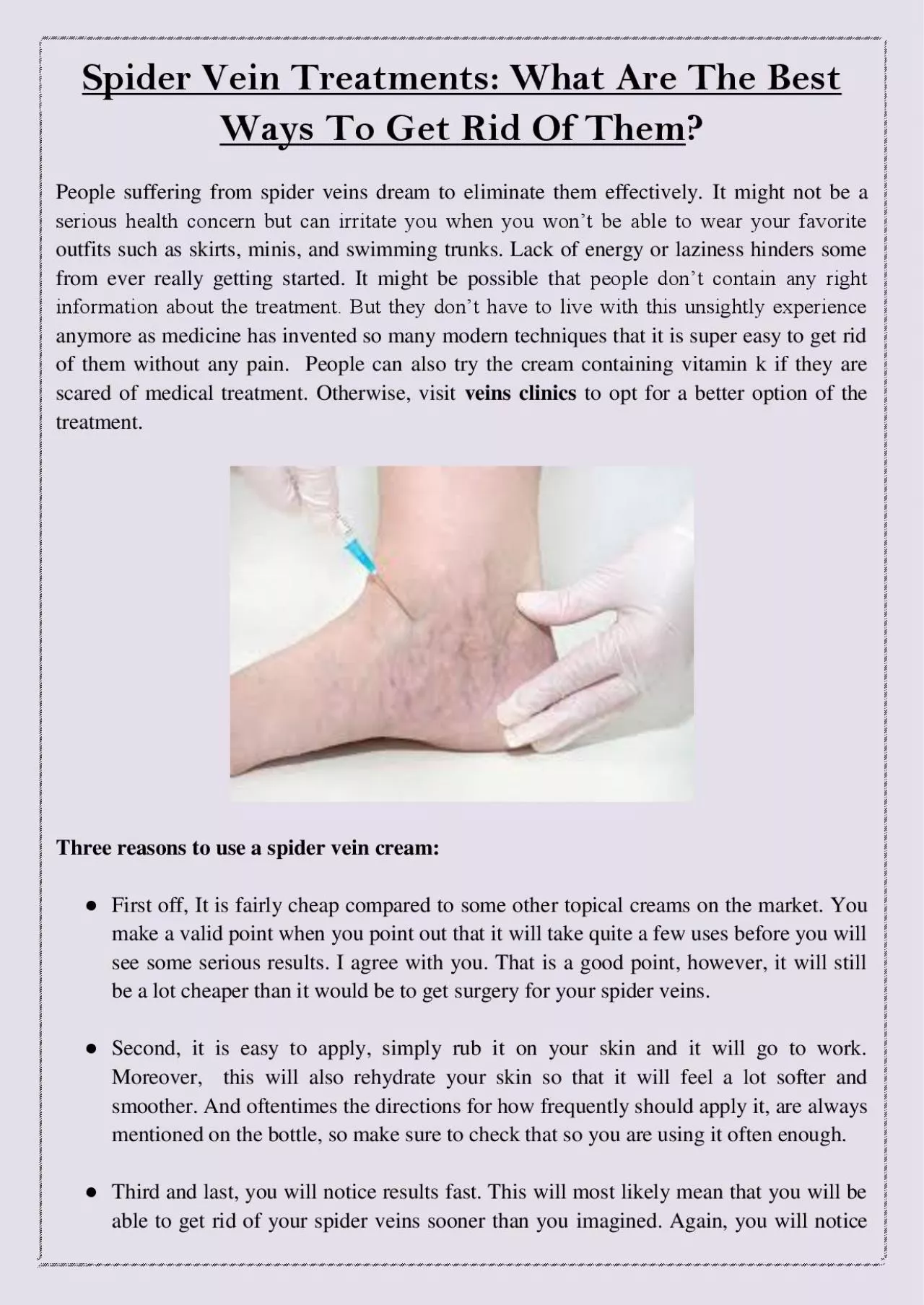 PDF-Spider Vein Treatments: What Are The Best Ways To Get Rid Of Them?