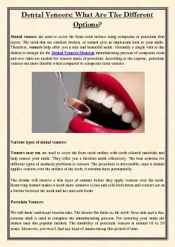 Dental Veneers: What Are The Different Options?