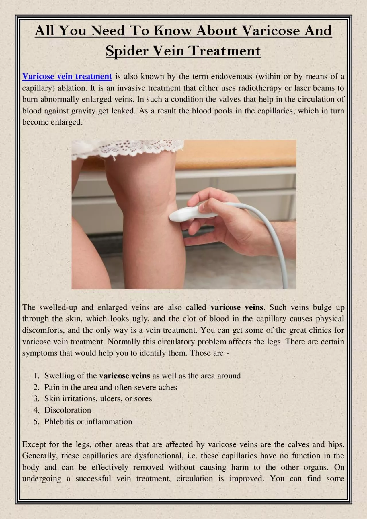 PDF-All You Need To Know About Varicose And Spider Vein Treatment