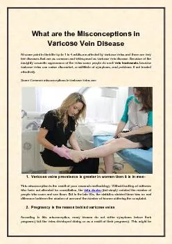 What are the Misconceptions in Varicose Vein Disease