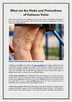 What are the Risks and Preventions of Varicose Veins