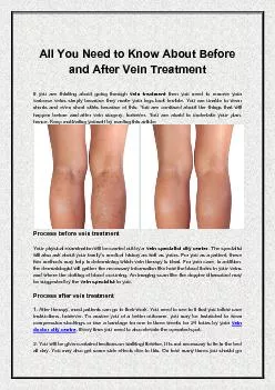All You Need to Know About Before and After Vein Treatment