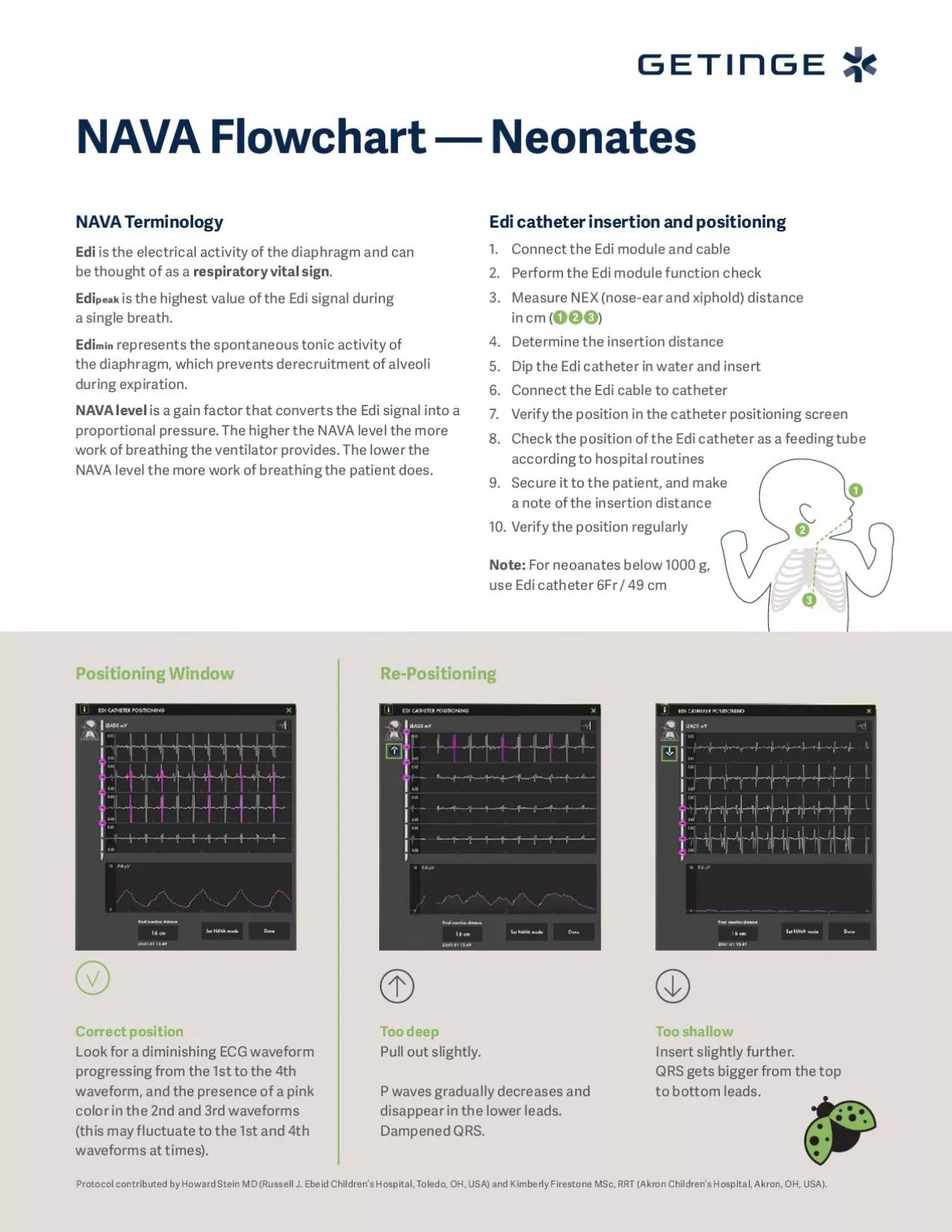 PDF-NAVA Flowchart 151 Neonates