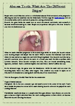Abscess Tooth: What Are The Different Stages?