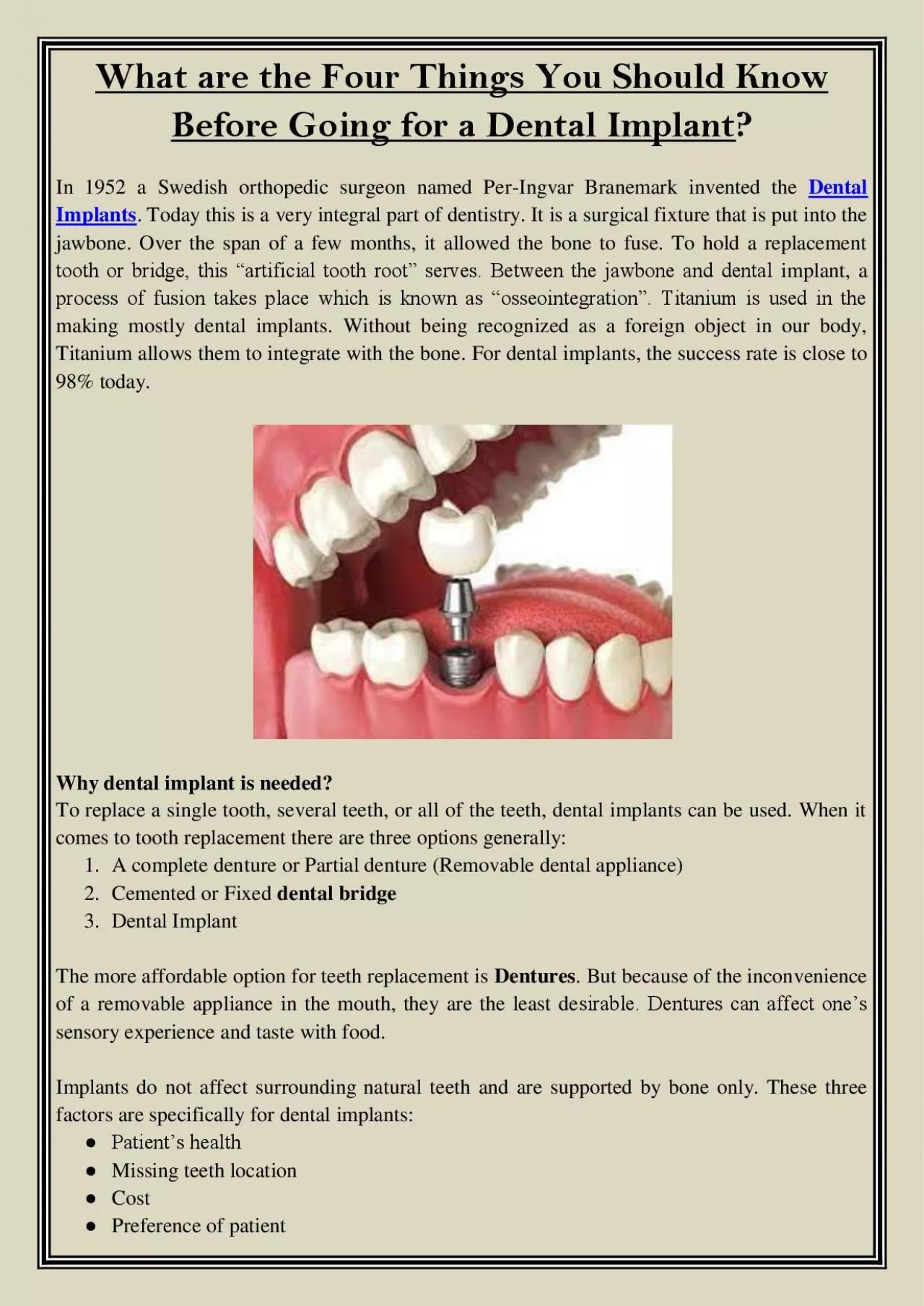 PDF-What are the Four Things You Should Know Before Going for a Dental Implant?