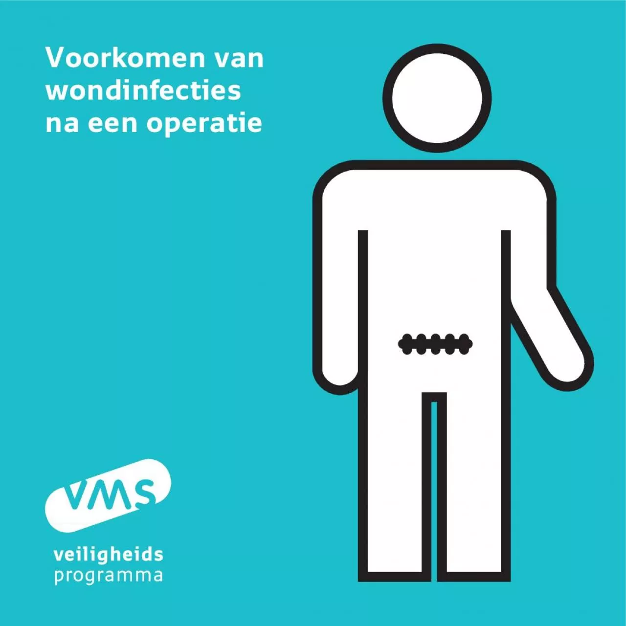 PDF-Voorkomen van wondinfecties