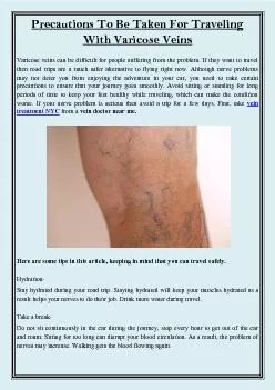 Precautions To Be Taken For Traveling With Varicose Veins